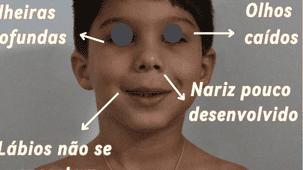 respirador-bucal-em-fortaleza-dr-adriano-abreu-dr-raquel-fiterman