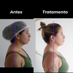dor no pescoço