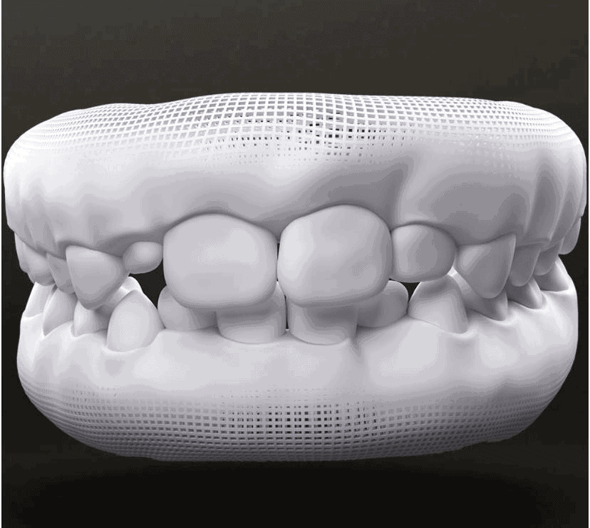 Tratamento para crianças com invisalign