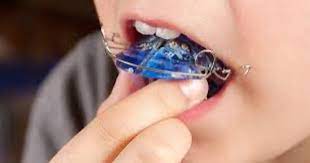 Ortodontia para crianças e adolescentes-dra-raquel-fiterman