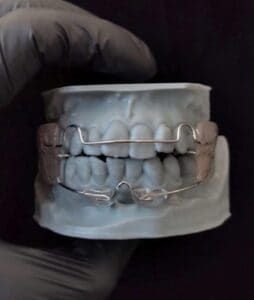 Método HBTC RFA DR Adriano Abreu