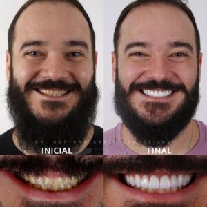 bruxismo em fortaleza