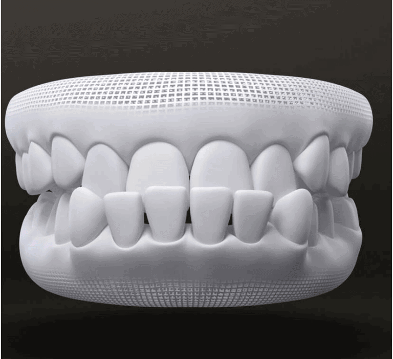 tratamento para prognatismo com invisalign